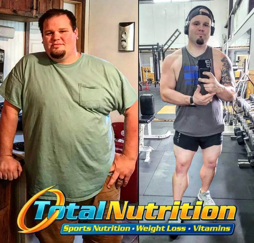 Before and after